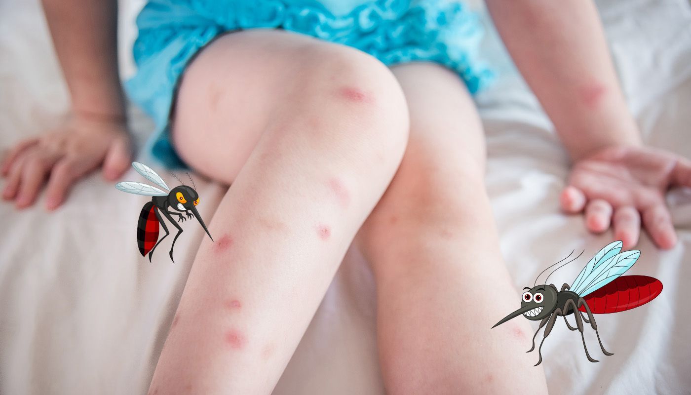 Komáří štípnutí, nebezpečí, reakce a prevence pomocí repelentů
